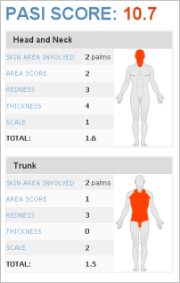 Psoriasis Bsa Chart